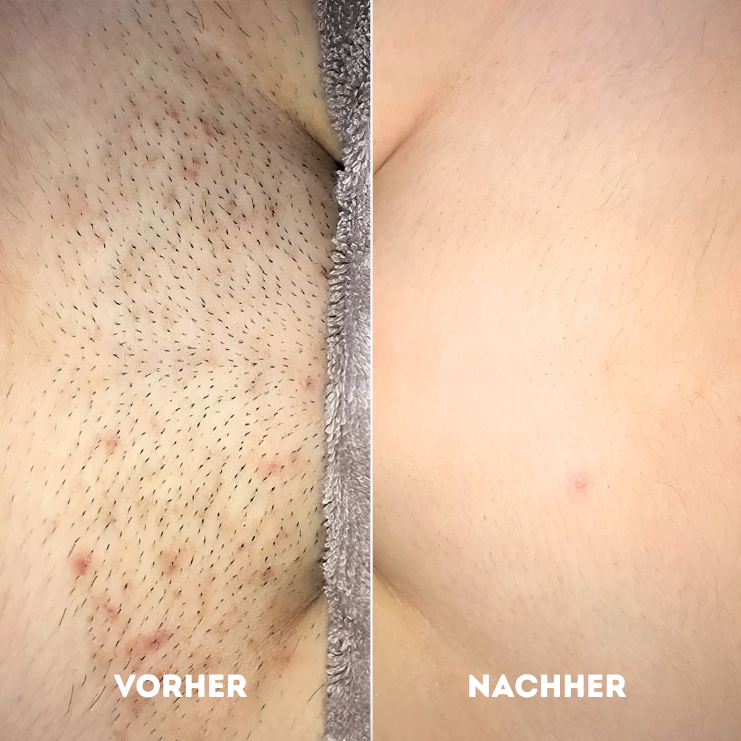 GlowR Hobel Set® für gesunde und glatte Haut